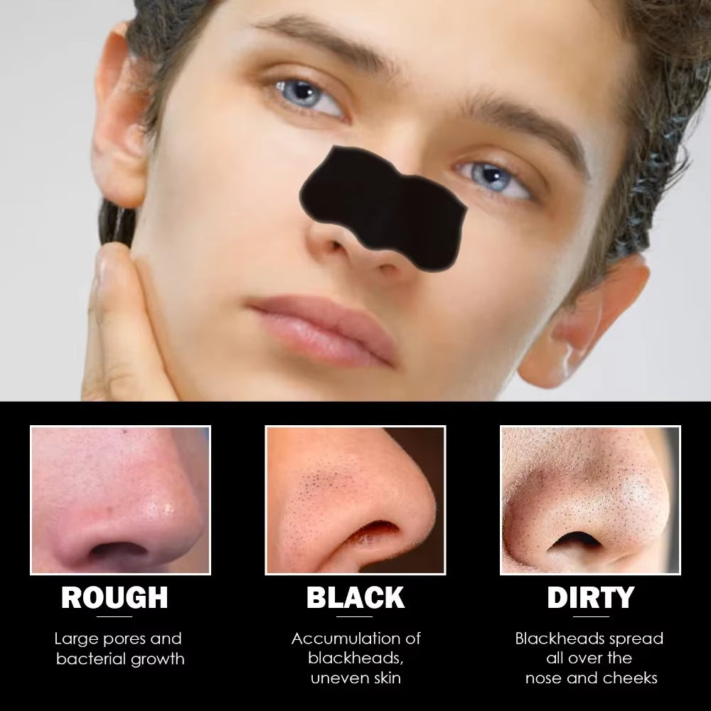 10Pcs Nose Blackhead Sticker Strip Mask for Nose Deep Cleaning Firming Shrink Pore Unisex Exfoliating Nasal Nose Skin Care Tool